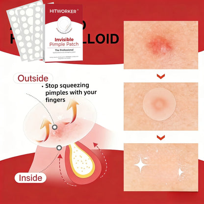 Invisible Pimple Patches