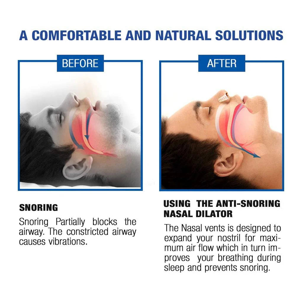 Silicone Anti-Snoring Nasal Dilator Nose Clip – Drug-Free Sleep Aid