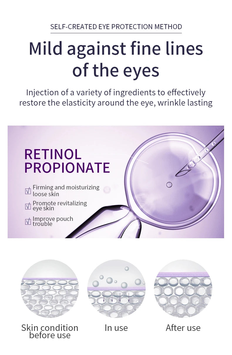 O'CHEAL Anti-Wrinkle & Dark Circle Eye Cream with Roller Massager