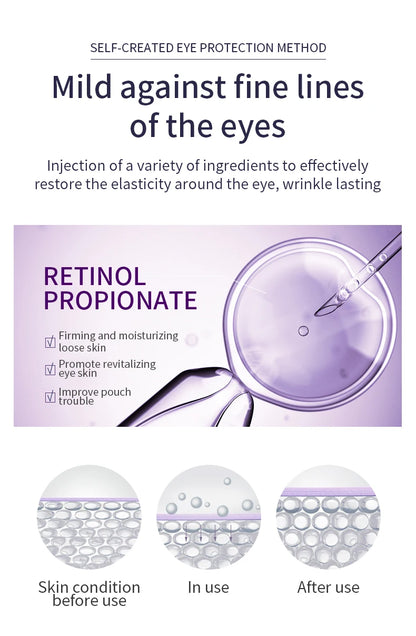 O'CHEAL Anti-Wrinkle & Dark Circle Eye Cream with Roller Massager