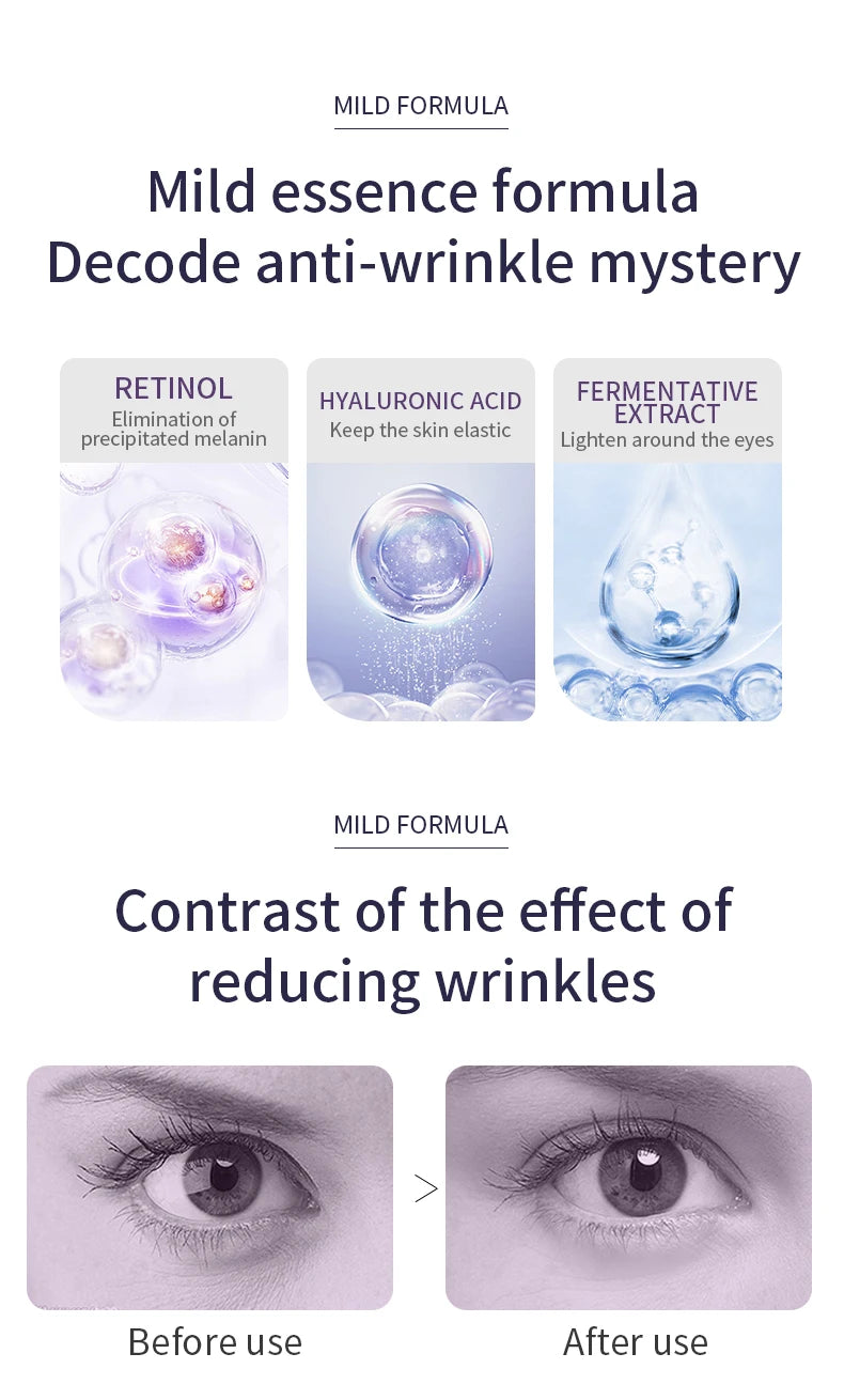 O'CHEAL Anti-Wrinkle & Dark Circle Eye Cream with Roller Massager